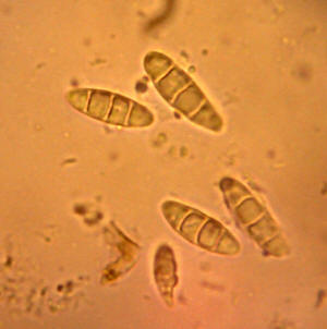 Sagiolechia rhexoblephara